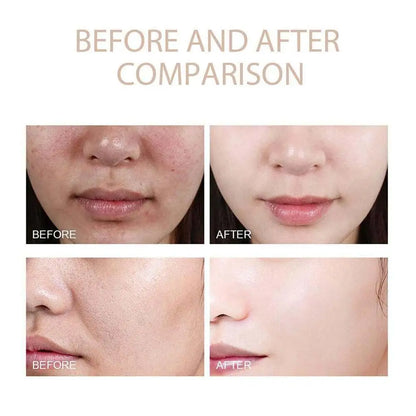 Radiant Skin Renewal Serum™